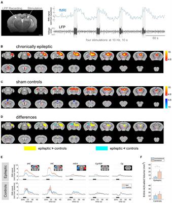 Probing hippocampal stimulation in experimental temporal lobe epilepsy with functional MRI